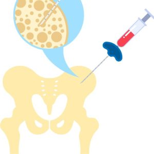 Bone marrow transplantation