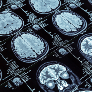 Diagnostic Imaging