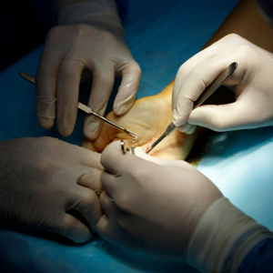 Hand and Wrist Surgery