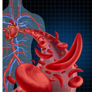 Hemoglobinopathies