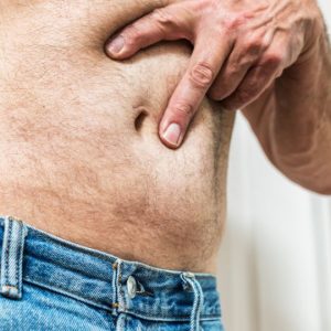 Hernia Repair