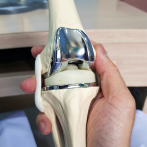 Joint Replacement Surgery