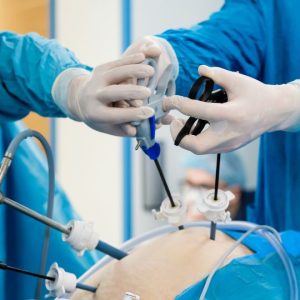 Laparoscopic surgery