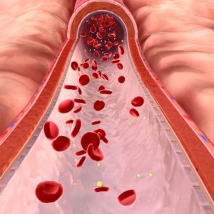 Lipid Disorders