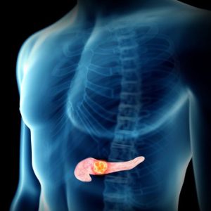 Pancreatic Disease Treatment