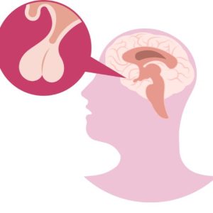 Pituitary Gland Disorders