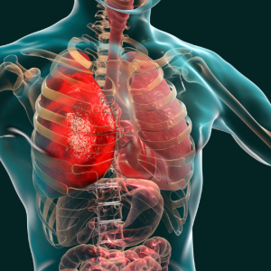 Respiratory Conditions