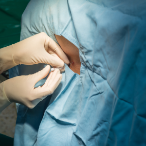 Spinal Surgery